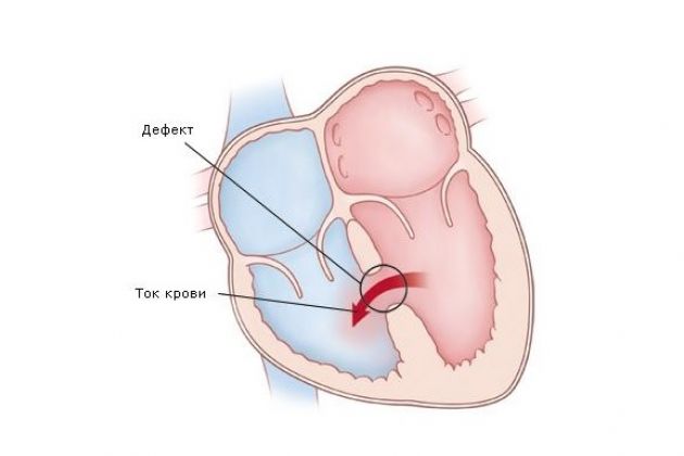 ����� ����������� � ������ �� ������� ����� ��������� ����� � ������